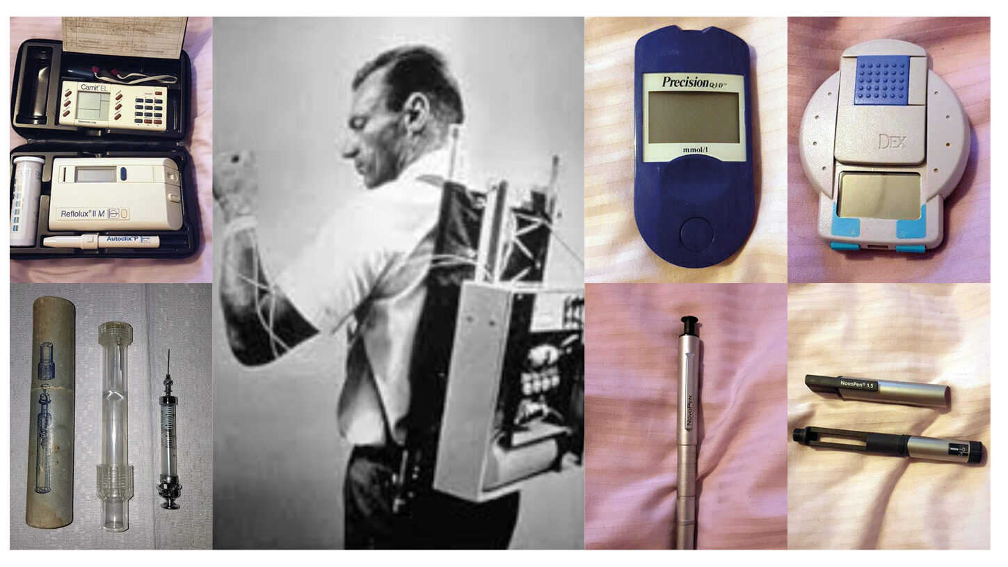 Diabetes typ 1 för 100 år sedan. När den första insulinpumpen kom var den stor som en rejäl ryggsäck och sågs som science fiction. Idag får pumpen plats under tröjan. 